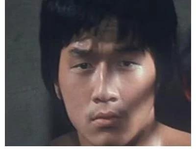 探尋小巷中的美麗秘密，割雙眼皮的價(jià)格是否昂貴？