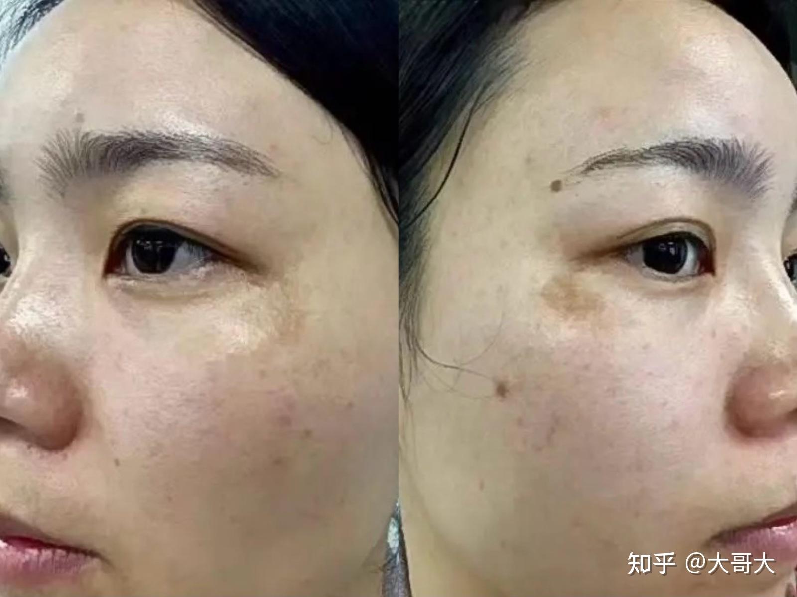 最新捕捉斑現(xiàn)象，多維視角深度解析
